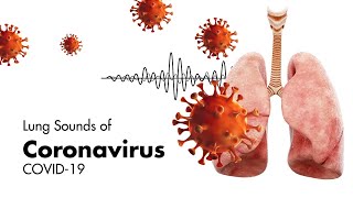 Sounds of Coronavirus COVID19  Lung Sounds [upl. by Ocko]