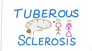 Tuberous Sclerosis Complex TSC [upl. by Reagan]