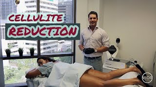 Reduce Cellulite With These Two Treatments [upl. by Venditti]