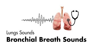 Bronchial Breath Sounds  Lung Sounds  Medzcool [upl. by Hound]