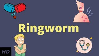 Ringworm Causes Signs and Symptoms Diagnosis and Treatment [upl. by Derf]