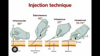 How To Do A Glute Injection  Full Guide And Demo [upl. by Anaek]