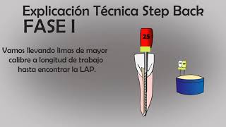 Técnica de instrumentación StepBack [upl. by Avruch]