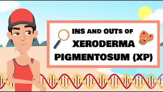 The Ins and Outs of XP Xeroderma pigmentosum [upl. by Nhar]